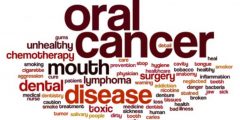 Dispelling The Myths About Oral Cancer
